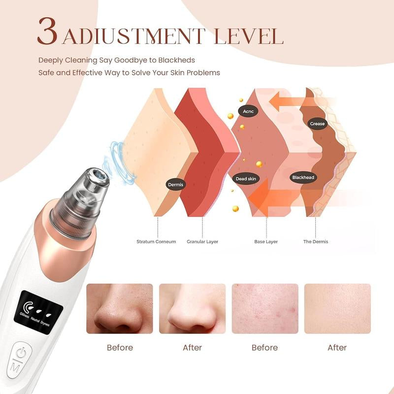 2026 Newest Blackhead Remover Pore Vacuum,Usb Rechargeable Blackhead Extractor